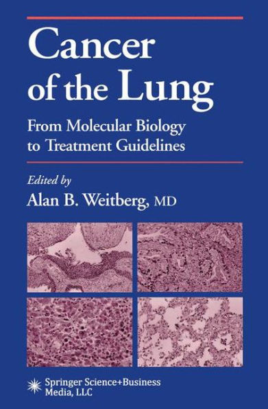 Cancer of the Lung: From Molecular Biology to Treatment Guidelines / Edition 1