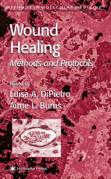 Wound Healing: Methods and Protocols / Edition 1