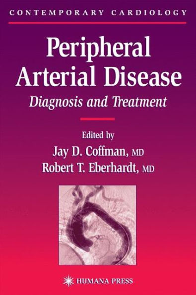 Peripheral Arterial Disease: Diagnosis and Treatment / Edition 1