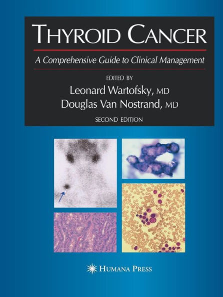 Thyroid Cancer: A Comprehensive Guide to Clinical Management / Edition 2