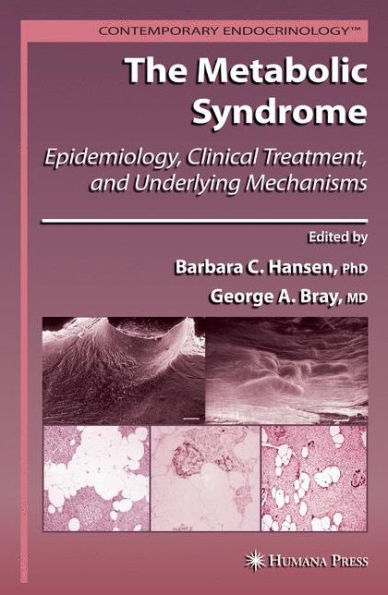 The Metabolic Syndrome:: Epidemiology, Clinical Treatment, and Underlying Mechanisms / Edition 1