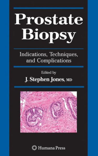 Prostate Biopsy: Indications, Techniques, and Complications / Edition 1