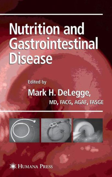Nutrition and Gastrointestinal Disease / Edition 1