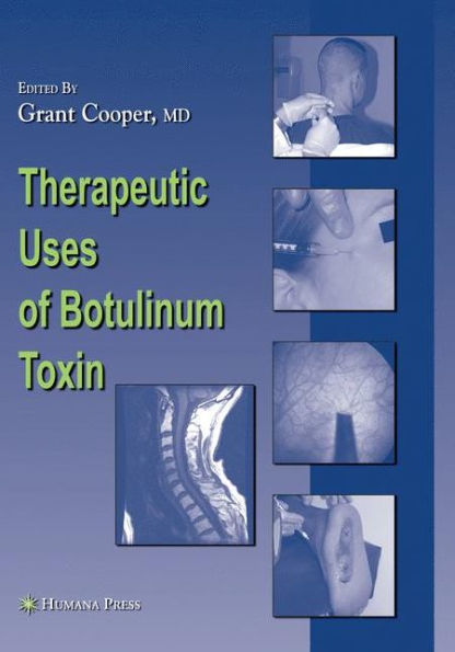 Therapeutic Uses of Botulinum Toxin / Edition 1