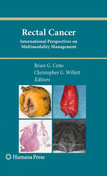 Rectal Cancer: International Perspectives on Multimodality Management / Edition 1