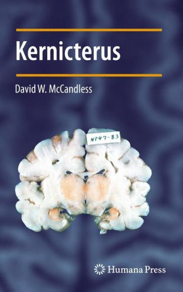 Kernicterus / Edition 1