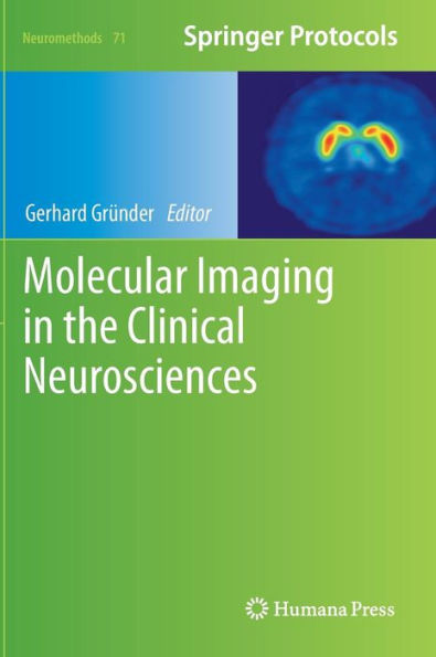 Molecular Imaging in the Clinical Neurosciences / Edition 1