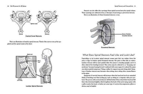 Safe Movement for All Spines: A Guide to Spinal Anatomy and How Work with 21 Spine Hip Conditions