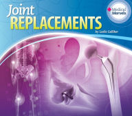 Title: Joint Replacements eBook, Author: Leslie Galliker