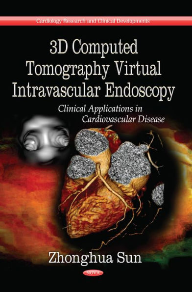 3D computed Tomography Virtual Intravascular Endoscopy: Clinical Applications in Cardiovascular Disease