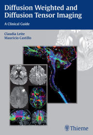 Download ebook free for mobile phone Diffusion Weighted and Diffusion Tensor Imaging: A Clinical Guide: A Clinical Guide