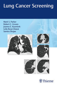 Title: Lung Cancer Screening, Author: Mark Parker