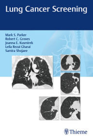 Title: Lung Cancer Screening, Author: Mark Parker