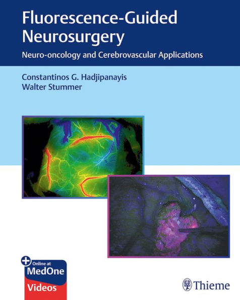 Fluorescence-Guided Neurosurgery: Neuro-oncology and Cerebrovascular Applications