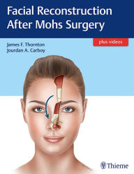 Free electronics books download Facial Reconstruction After Mohs Surgery by James Thornton in English PDF FB2 9781626237346