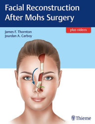 Ebook free download mobi format Facial Reconstruction After Mohs Surgery DJVU PDF by James Thornton (English literature) 9781626237346