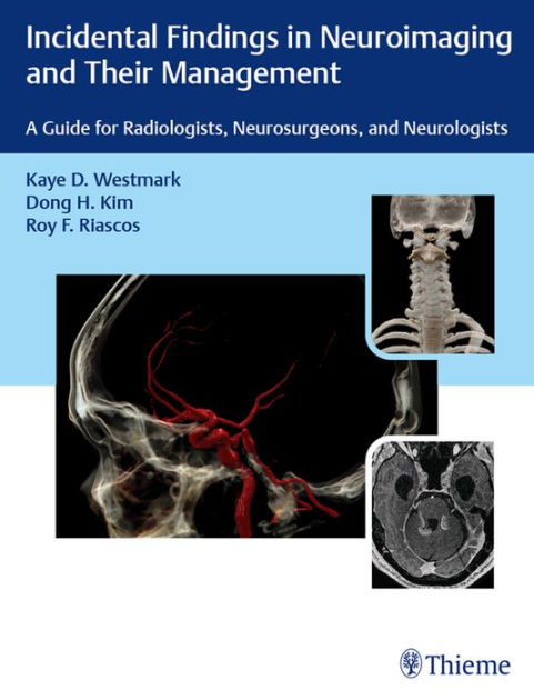 Incidental Findings in Neuroimaging and Their Management: A Guide for ...