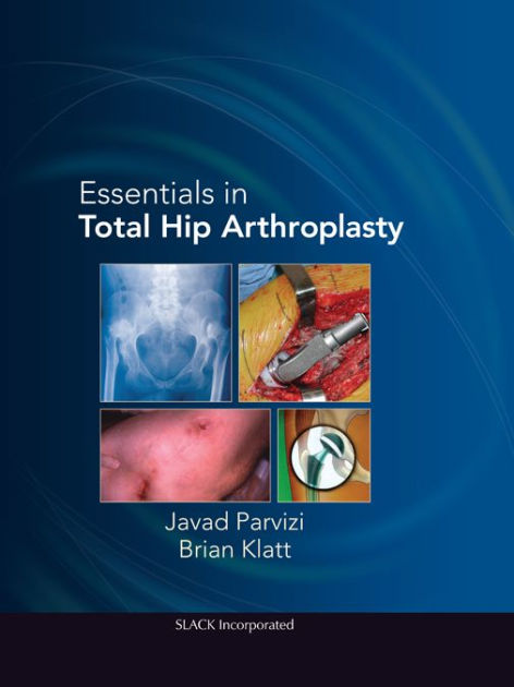 Essentials in Total Hip Arthroplasty by Javad Parvizi | eBook | Barnes ...