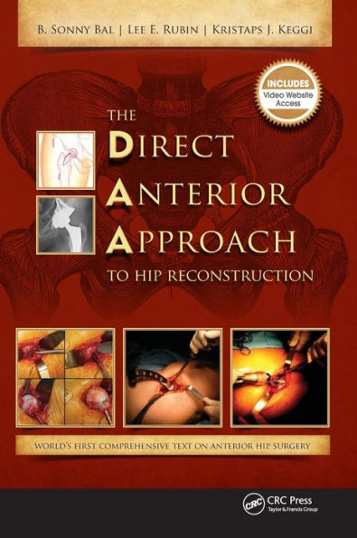 The Direct Anterior Approach to Hip Reconstruction / Edition 1