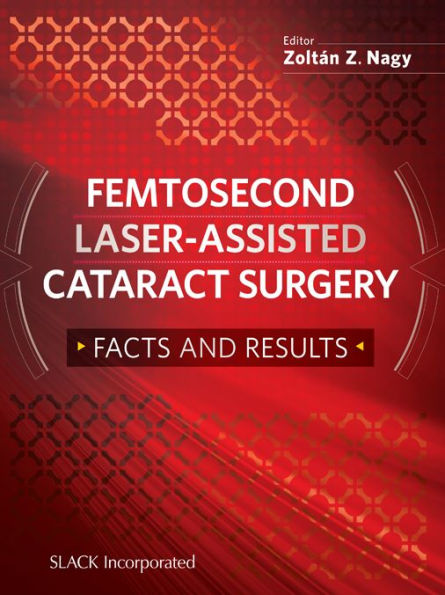 Femtosecond Laser-Assisted Cataract Surgery: Facts and Results