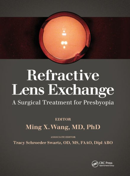 Refractive Lens Exchange: A Surgical Treatment for Presbyopia