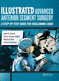 Title: Illustrated Advanced Anterior Segment Surgery: A Step-by-Step Guide for Challenging Cases / Edition 1, Author: Iqbal Ahmed