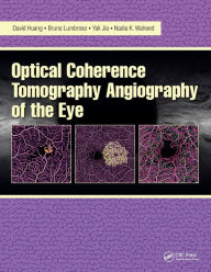 Title: Optical Coherence Tomography Angiography of the Eye: Oct Angiography, Author: David Huang MD PhD