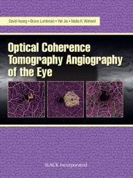 Title: Optical Coherencre Tomography Angiography of the Eye, Author: David Huang