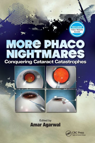 More Phaco Nightmares: Conquering Cataract Catastrophes / Edition 1