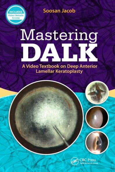 Mastering DALK: A Video Textbook on Deep Anterior Lamellar Keratoplasty / Edition 1