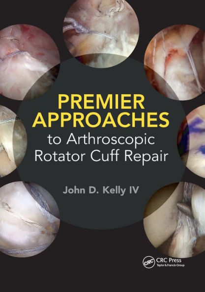 Premier Approaches to Arthroscopic Rotator Cuff Repair / Edition 1