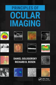 Title: Principles of Ocular Imaging / Edition 1, Author: Daniel Gologorsky