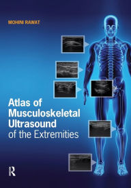 Title: Atlas of Musculoskeletal Ultrasound of the Extremities / Edition 1, Author: Mohini Rawat