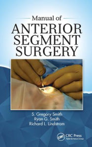 Title: Manual of Anterior Segment Surgery / Edition 1, Author: S Gregory Smith