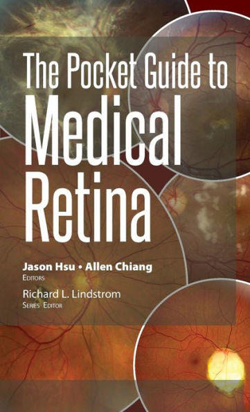 The Pocket Guide to Medical Retina / Edition 1