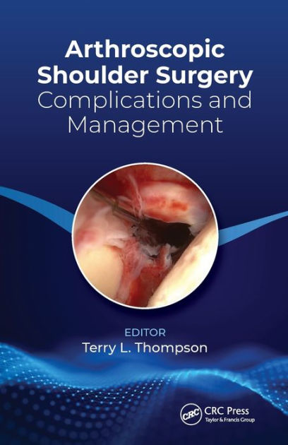 Arthroscopic Shoulder Surgery: Complications and Management / Edition 1 ...