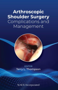 Title: Arthroscopic Shoulder Surgery: Complications and Management / Edition 1, Author: Terry Thompson