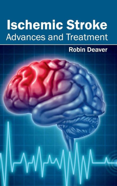 Ischemic Stroke: Advances and Treatment