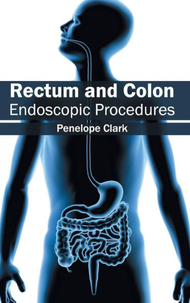 Rectum and Colon: Endoscopic Procedures