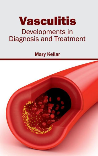 Vasculitis: Developments in Diagnosis and Treatment