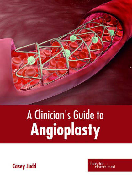 A Clinician's Guide to Angioplasty