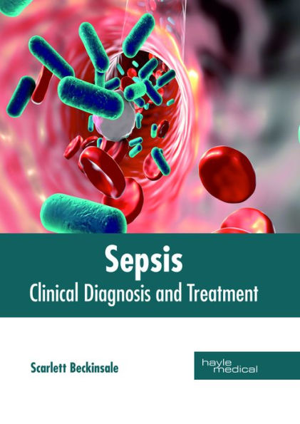 Sepsis: Clinical Diagnosis and Treatment