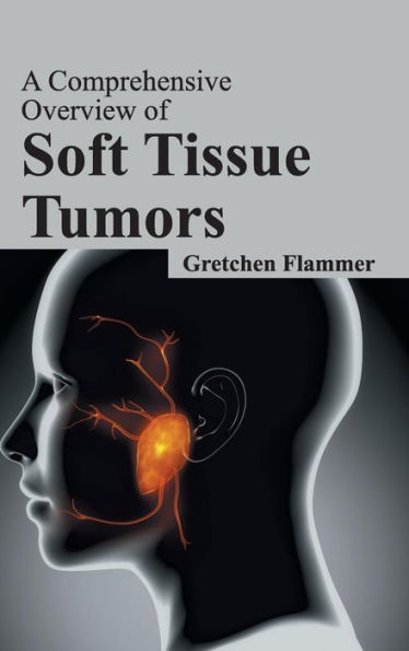 Comprehensive Overview of Soft Tissue Tumors