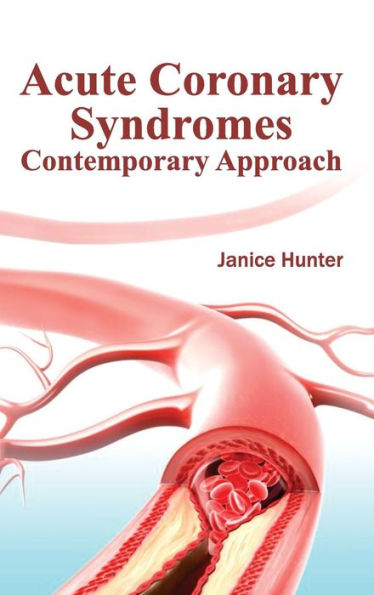 Acute Coronary Syndromes: Contemporary Approach