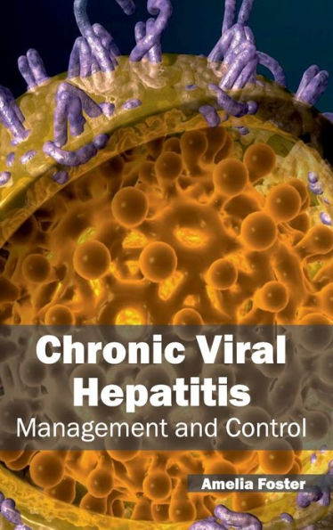 Chronic Viral Hepatitis: Management and Control