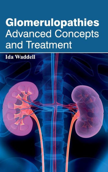 Glomerulopathies: Advanced Concepts and Treatment