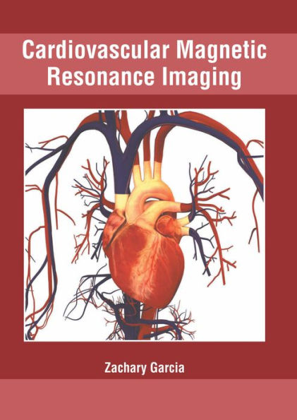 Cardiovascular Magnetic Resonance Imaging