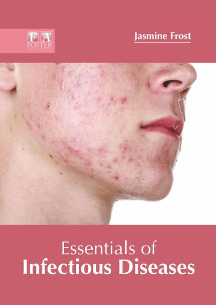 Essentials of Infectious Diseases