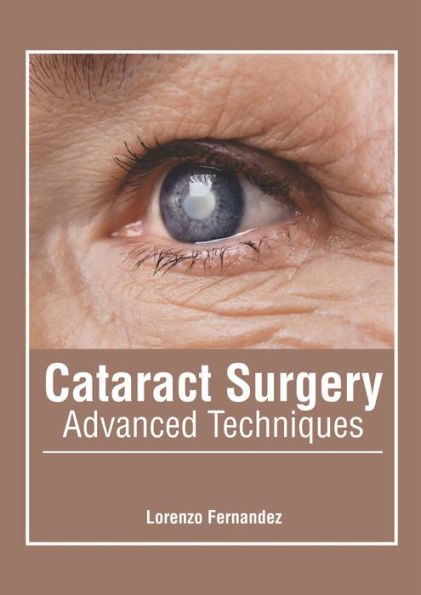 Cataract Surgery: Advanced Techniques