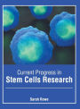 Current Progress in Stem Cells Research